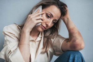 Portrait-of-female-employee-with-bruises-on-arms,-feeling-hopeless,-making-phone-call.